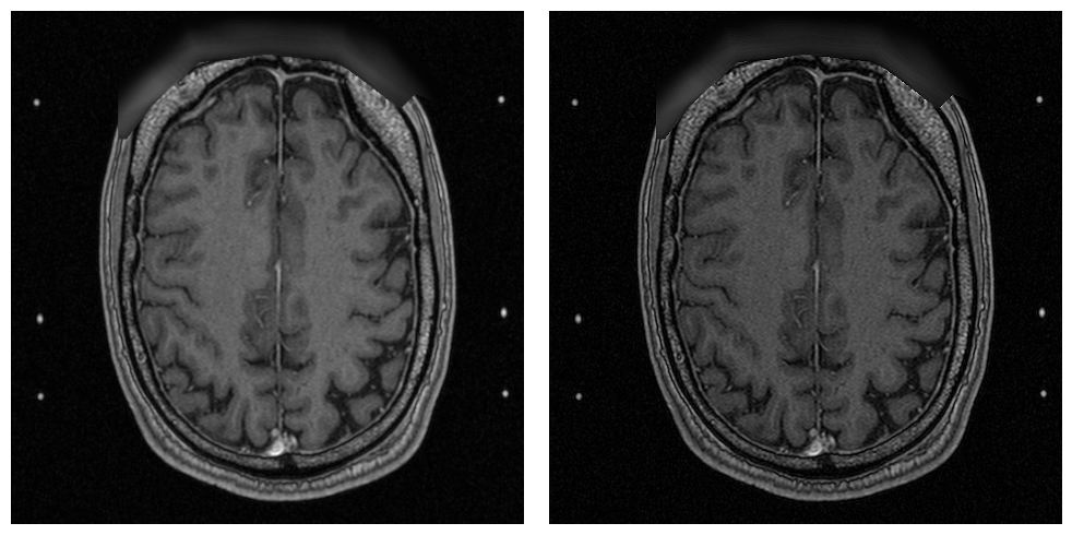 _images/examples.processing.basic_processing_11_1.png