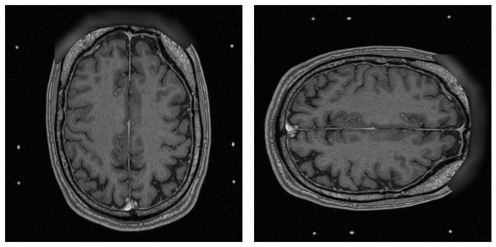 _images/examples.processing.basic_processing_14_1.png