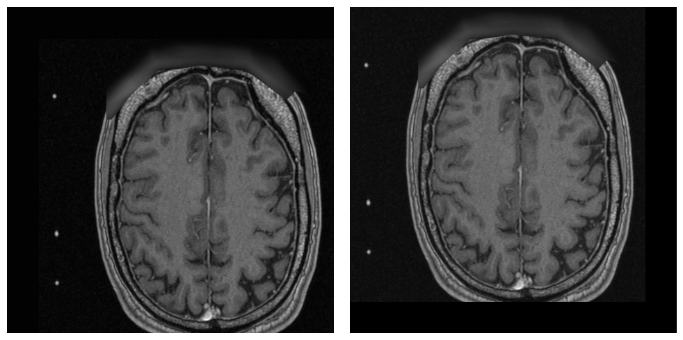 _images/examples.processing.basic_processing_22_3.png