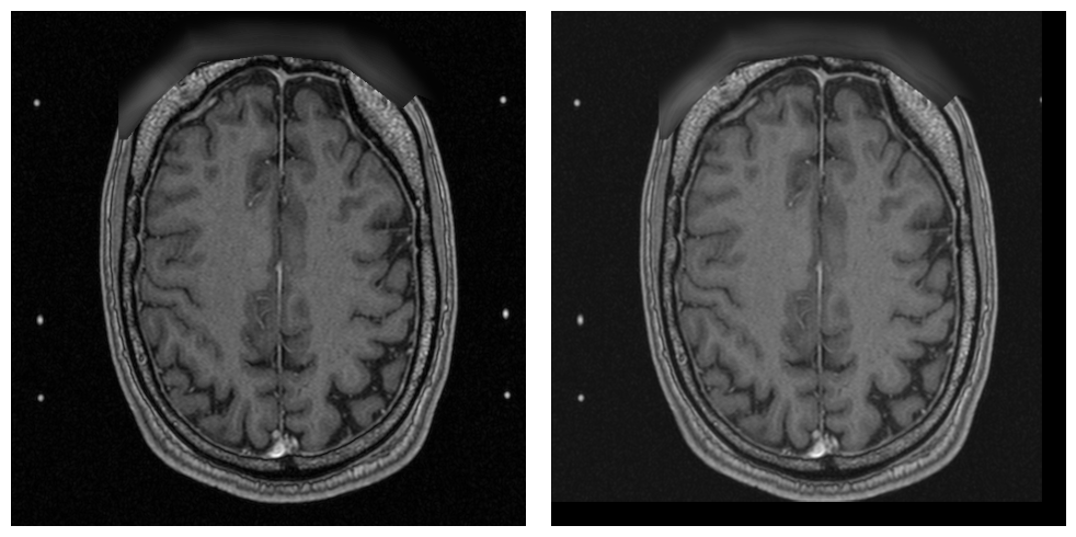 _images/examples.processing.basic_processing_30_1.png