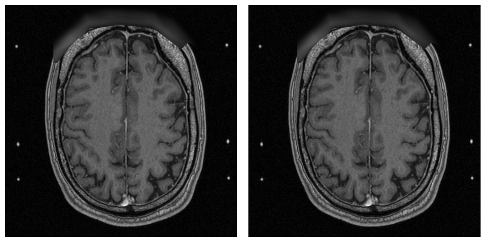 _images/examples.processing.basic_processing_7_3.png