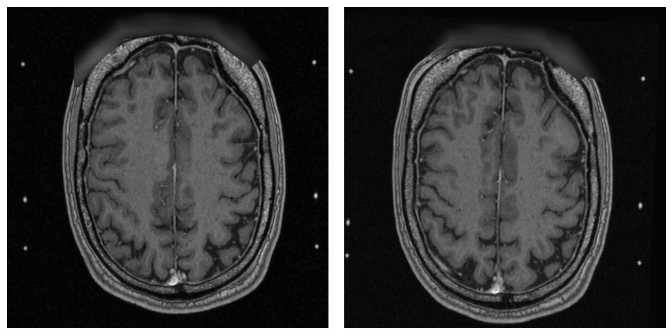 _images/examples.processing.basic_processing_19_1.png