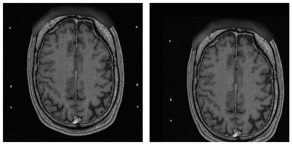 _images/examples.processing.basic_processing_22_1.png