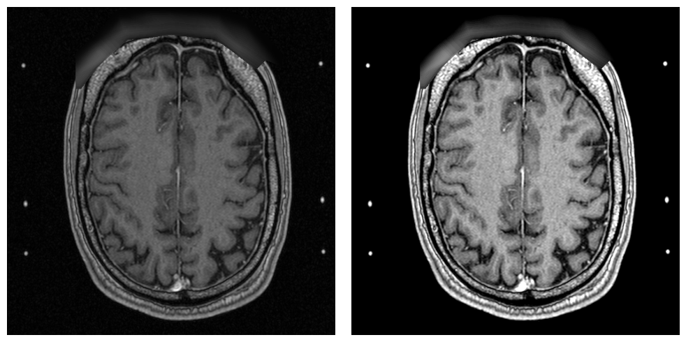 _images/examples.processing.basic_processing_9_1.png