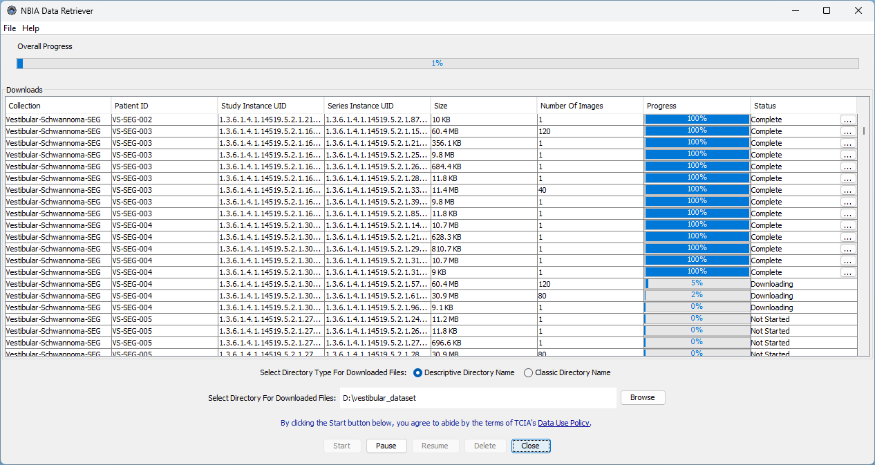 Screenshot of the NBIA Data Receiver downloading the Vestibular-Schwannoma-SEG dataset